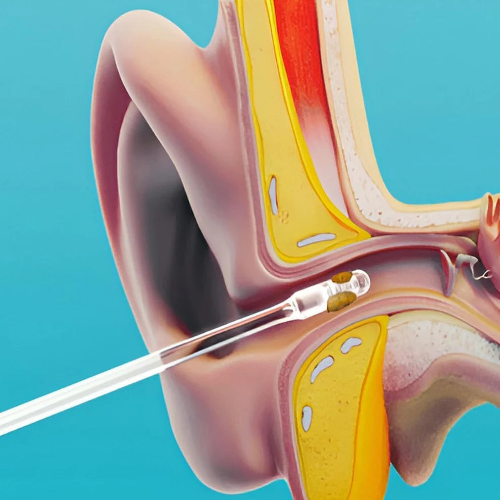 Silicone Reusable Ear wax Cleaner Stick  (12 Pcs)